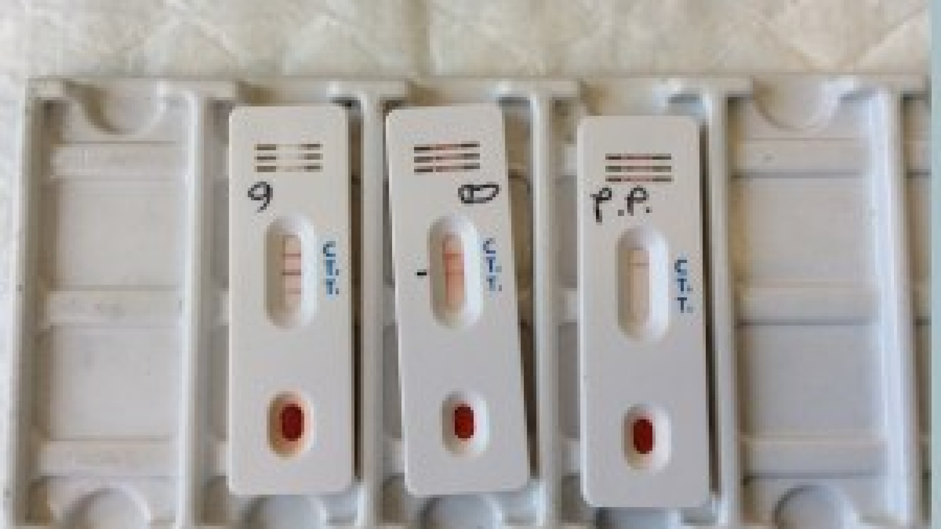 Test sierologici, nel Piacentino per ora un solo ambulatorio autorizzato